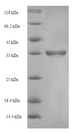 CSB-EP855470HU SDS