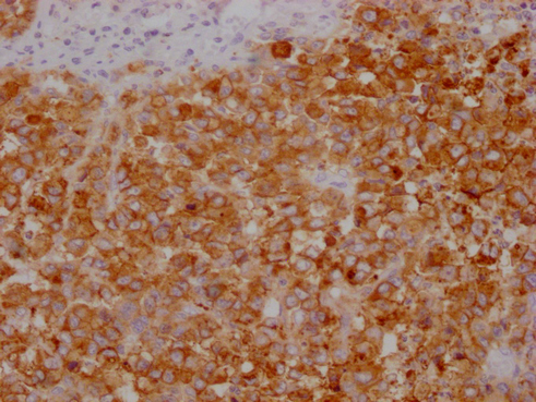 CSB-MA995583-IHC-2