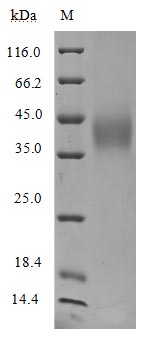 CSB-MP004902HU SDS-page