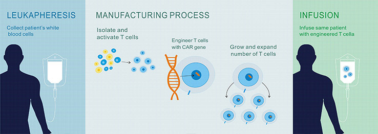 CAR-T细胞治疗的过程